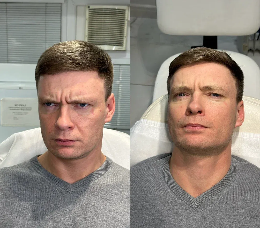 Диспорт